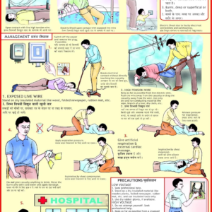 Electric Shock Chart
